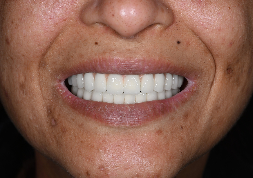 After