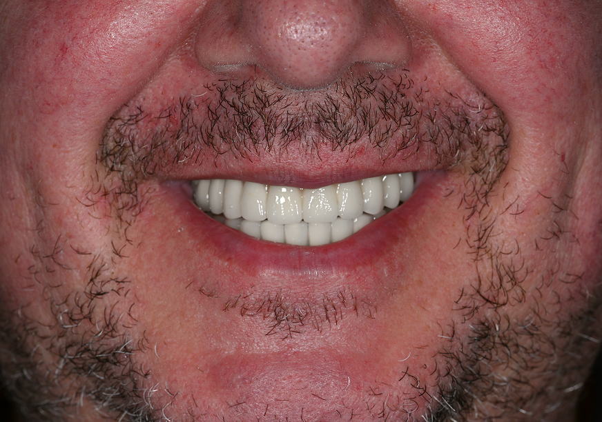 After
